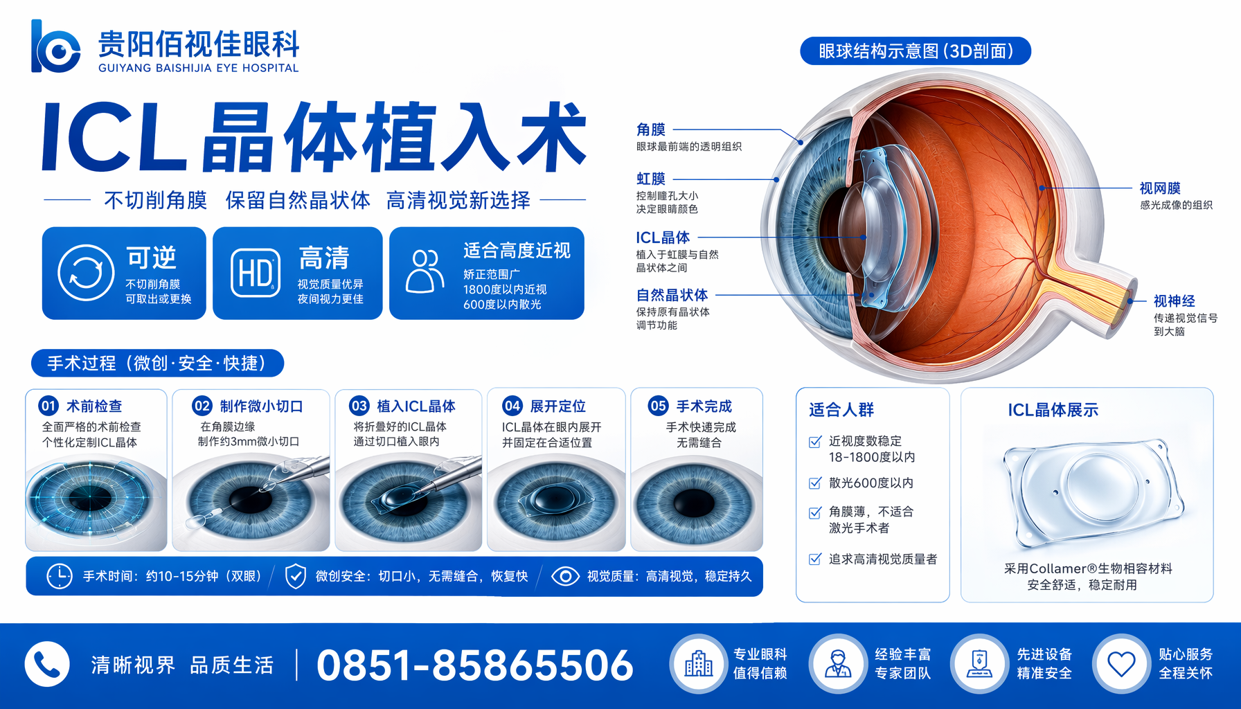 贵阳佰视佳眼科 ICL 晶体植入 贵阳市 贵阳佰视佳眼科 ICL 晶体植入手术,适合高度近视